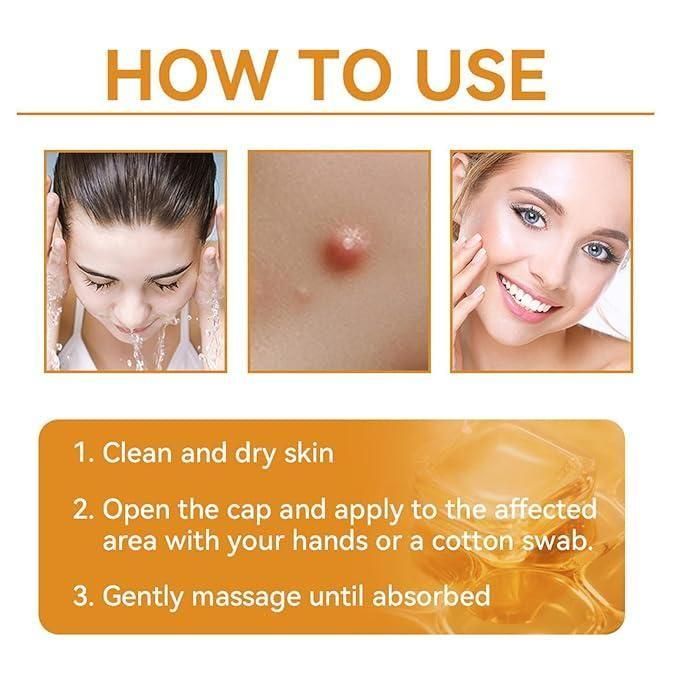 Bee Venom Skin Treatment Cream 100g (Pack of 2) - Wishlect