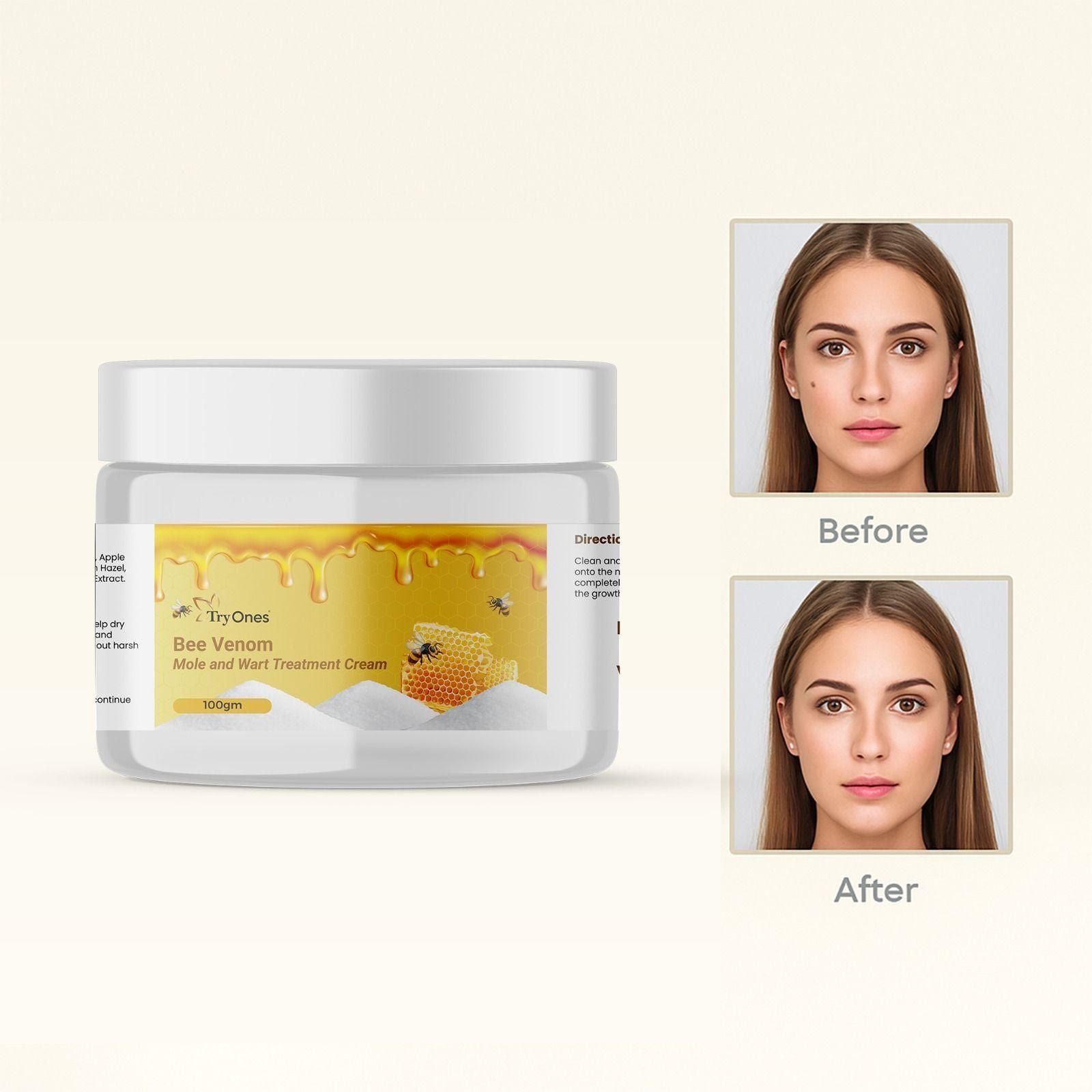 Bee Venom Mole and Wart Treatment Cream 100 gm Pack of 1 - Wishlect